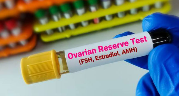 Yumurtalık Rezervi Nedir? AMH, FSH ve Antral Folikül Testleri Ne Anlatır?
